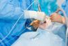 Dévitalisation d’une dent : votre avocat en responsabilité suite à une erreur de chirurgie dentaire à Nîmes Dévitalisation d’une dent : votre avocat en responsabilité suite à une erreur de chirurgie dentaire à Nîmes