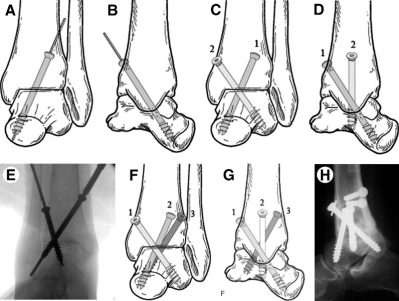 3-figure3-1.png 3-figure3-1.png