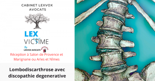 lombodiscarthrose-avec-discopathie-degenerative.png