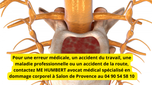 hyperostose-vertebrale-engainante-comment-diagnostiquer-la-maladie-.png