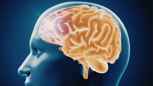 lesion-cerebrale-guerison-a-arle-1-.png lesion-cerebrale-guerison-a-arle-1-.png