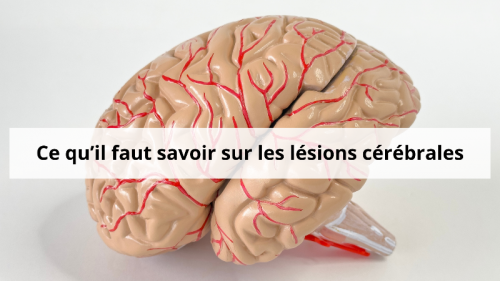 lesion-cerebrale-guerison-a-arle-2-.png lesion-cerebrale-guerison-a-arle-2-.png