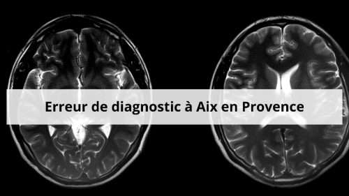 lesion-cerebrale-irm-a-aix-en-provence-2-.png