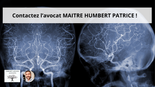 lesion-cerebrale-irm-a-aix-en-provence-3-.png lesion-cerebrale-irm-a-aix-en-provence-3-.png