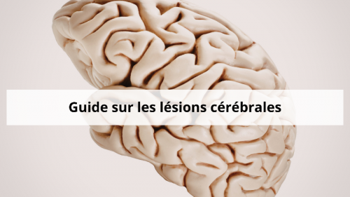 lesion-cerebrale-irm-a-aix-en-provence.png