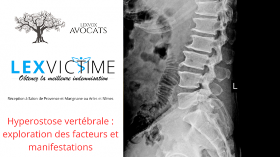 hyperostose-vertebrale-exploration-des-facteurs-et-manifestations--1-.png