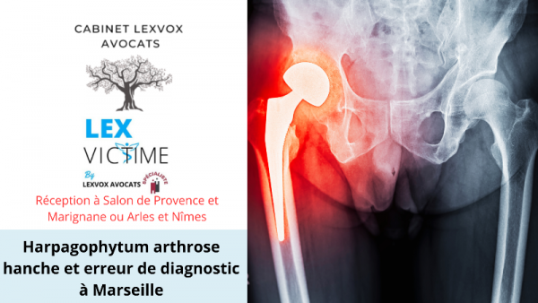 harpagophytum-arthrose_-et-erreur-de-diagnostic-a-marseille.png