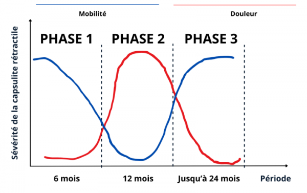 Phase de la capsulite