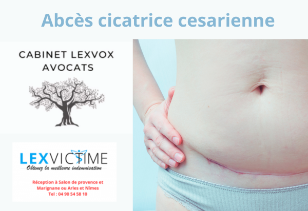 abces-cicatrice-cesarienne.png