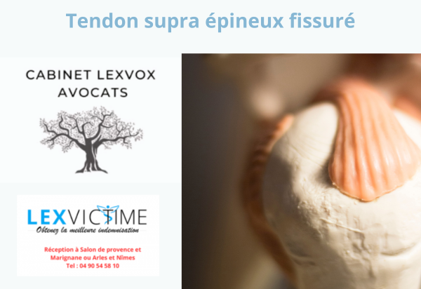 tendon-supra-epineux-fissure.png