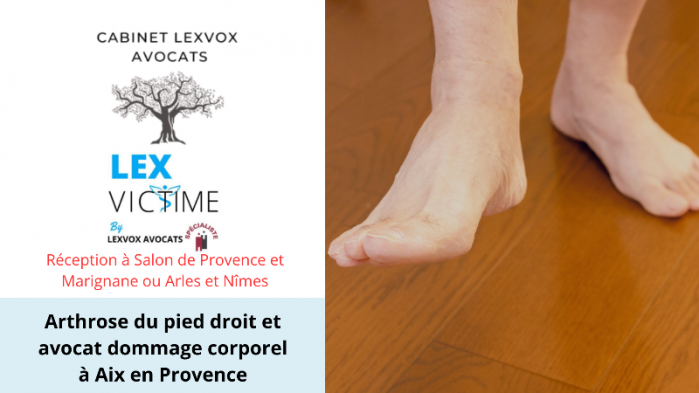 arthrose-du-pied-droit-et-avocat-dommage-corporel-a-aix-en-provence.png