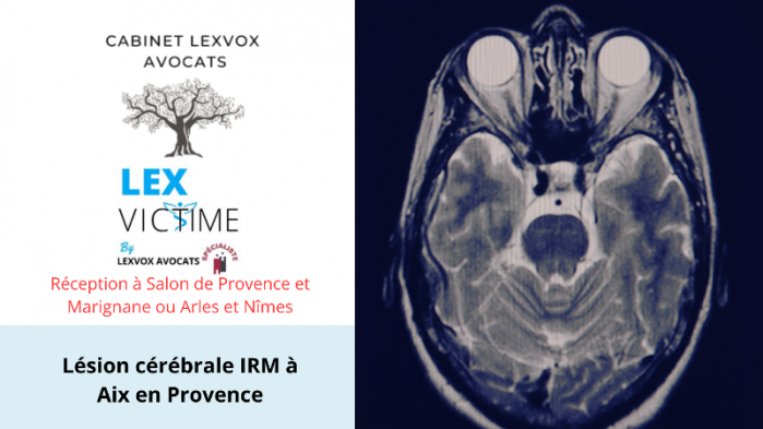 lesion-cerebrale-irm-a-aix-en-provence-1-.png