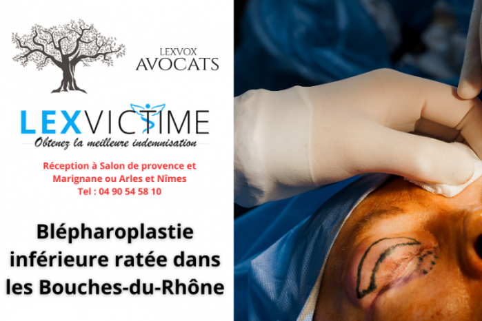 Blépharoplastie paupière inférieure