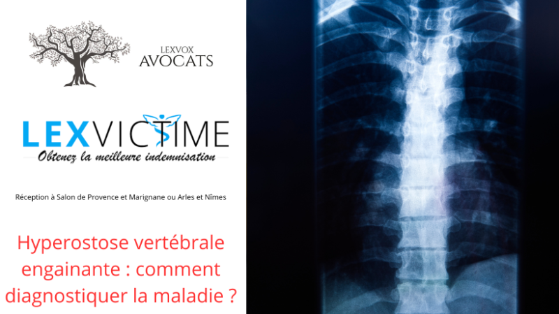 hyperostose-vertebrale-engainante-comment-diagnostiquer-la-maladie--1-.png