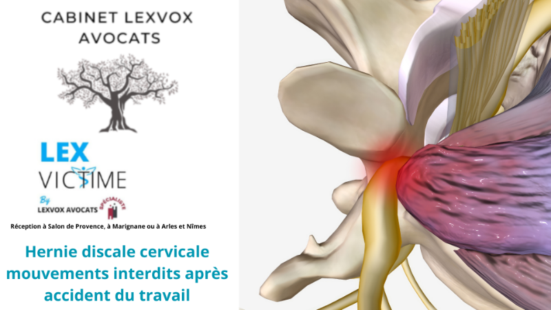 hernie-discale-cervicale-mouvements-interdits-apres-accident-du-travail-1.png