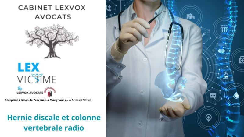 hernie-discale-et-colonne-vertebrale-radio.jpg