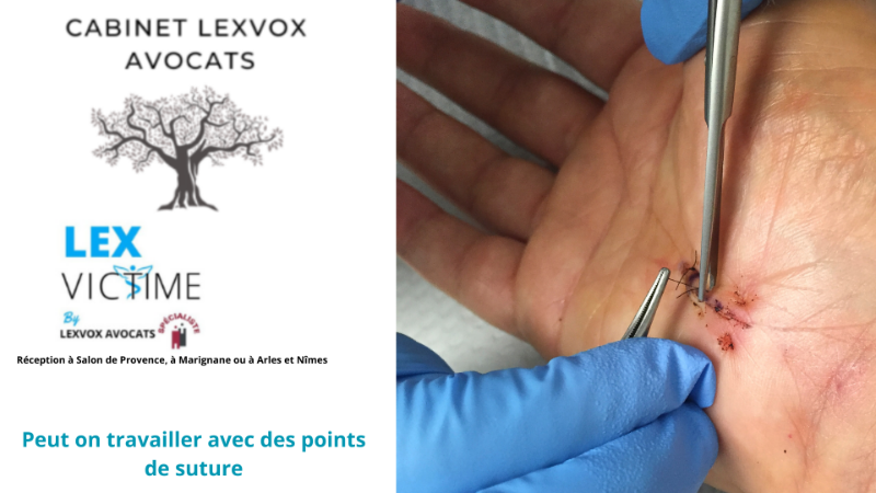 Travailler avec des points de suture