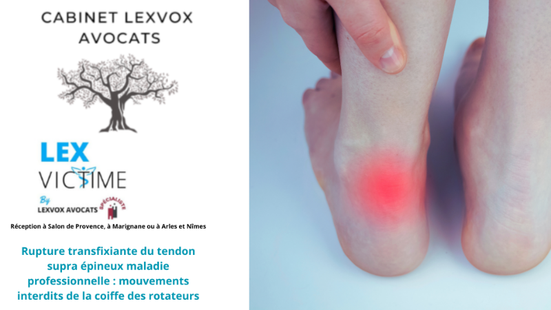 Rupture du Tendon Quadricipital : Comprendre les Implications au Niveau du Genou et de la Rotule