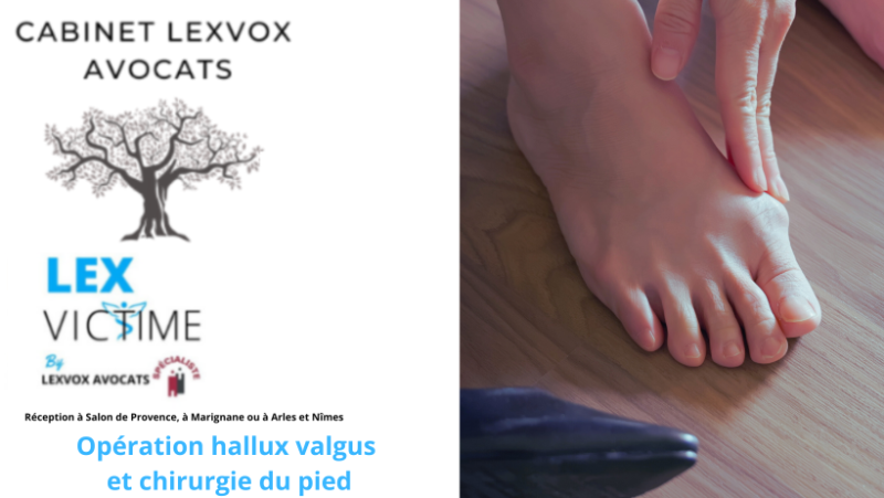 Hallux valgus