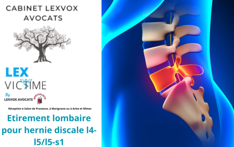 Etirement lombaire pour hernie discale l4-l5/l5-s1