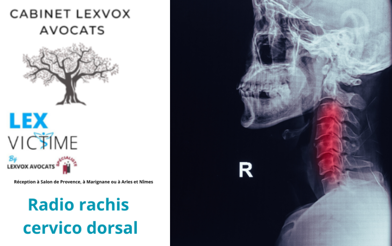 Radio rachis cervico dorsal