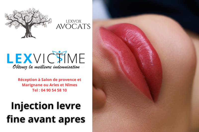 injection-levre-fine-avant-apres--1-.png