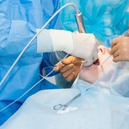 Dévitalisation d’une dent : votre avocat en responsabilité suite à une erreur de chirurgie dentaire  à Nîmes
