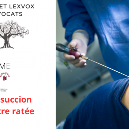 Liposuccion ventre ratée  