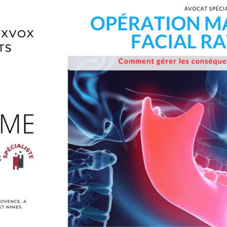 opération maxillo facial raté : Comment gérer les conséquences et être indemnisé