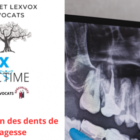 Opération des dents de sagesse