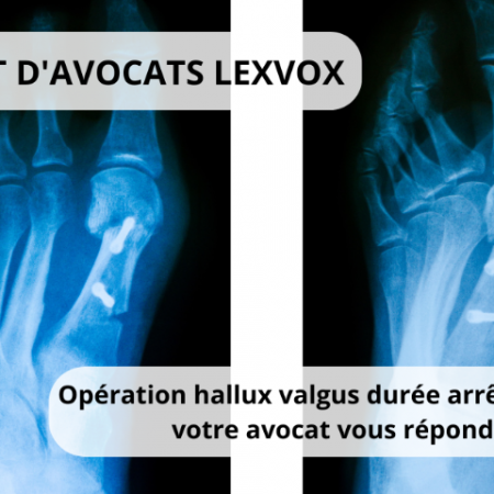 Opération hallux valgus durée arrêt travail : votre avocat vous répond !