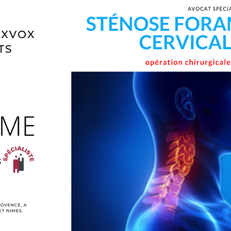 sténose foraminale cervicale : faute du chirurgien et indemnisation de la victime