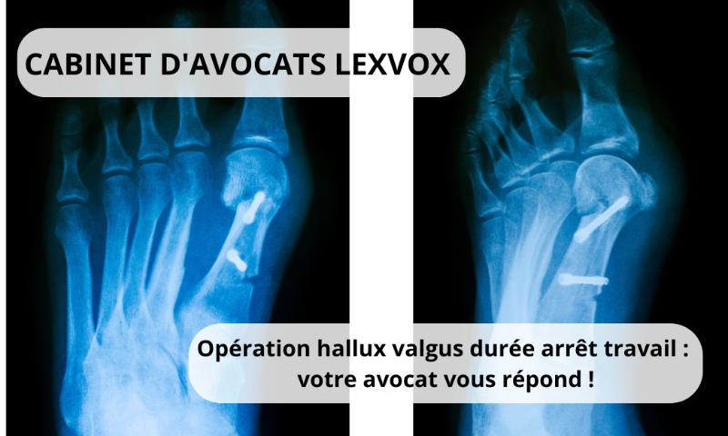 Quelle chaussure apres hotsell operation hallux valgus